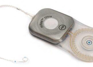 ỐC TAI ĐIỆN TỬ MEDEL TRIỂN KHAI CHƯƠNG TRÌNH MỚI TẠI HÀ NỘI BỘ CẤY ỐC TAI ĐIỆN TỬ (COCHLEAR IMPLANT)