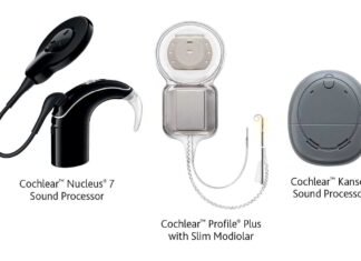 ỐC TAI ĐIỆN TỬ HOẠT ĐỘNG NHƯ THẾ NÀO HỆ THỐNG ỐC TAI ĐIỆN TỬ