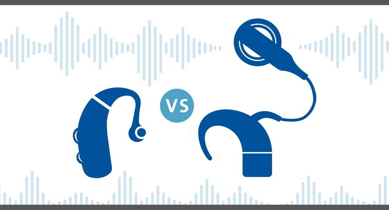 Lựa chọn máy trợ thính hay ốc tai điện tử?